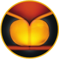 유로리프트 시술과정 01