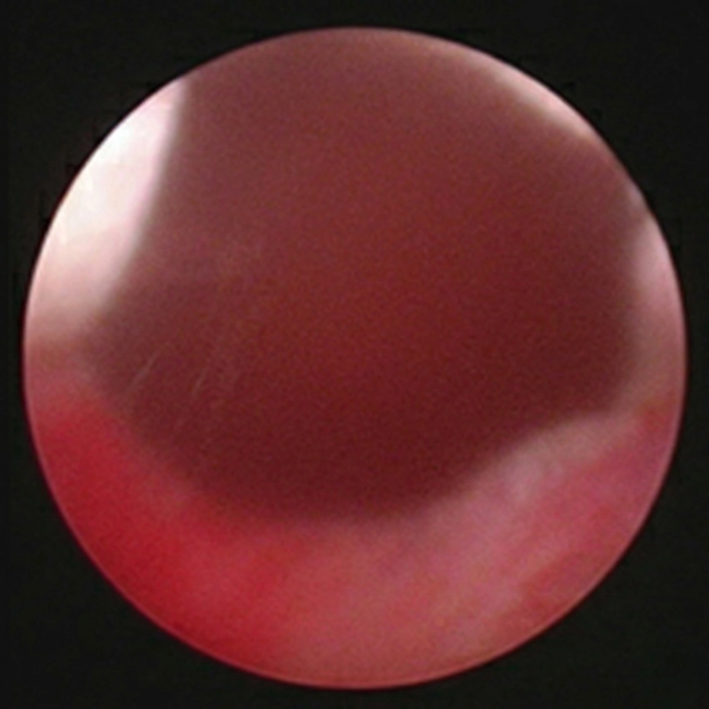 51세 남성 케이스 시술 전 내시경 이미지