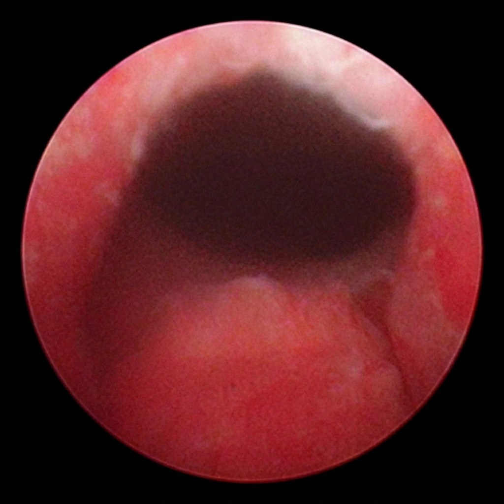 51세 남성 케이스 시술 후 내시경 이미지