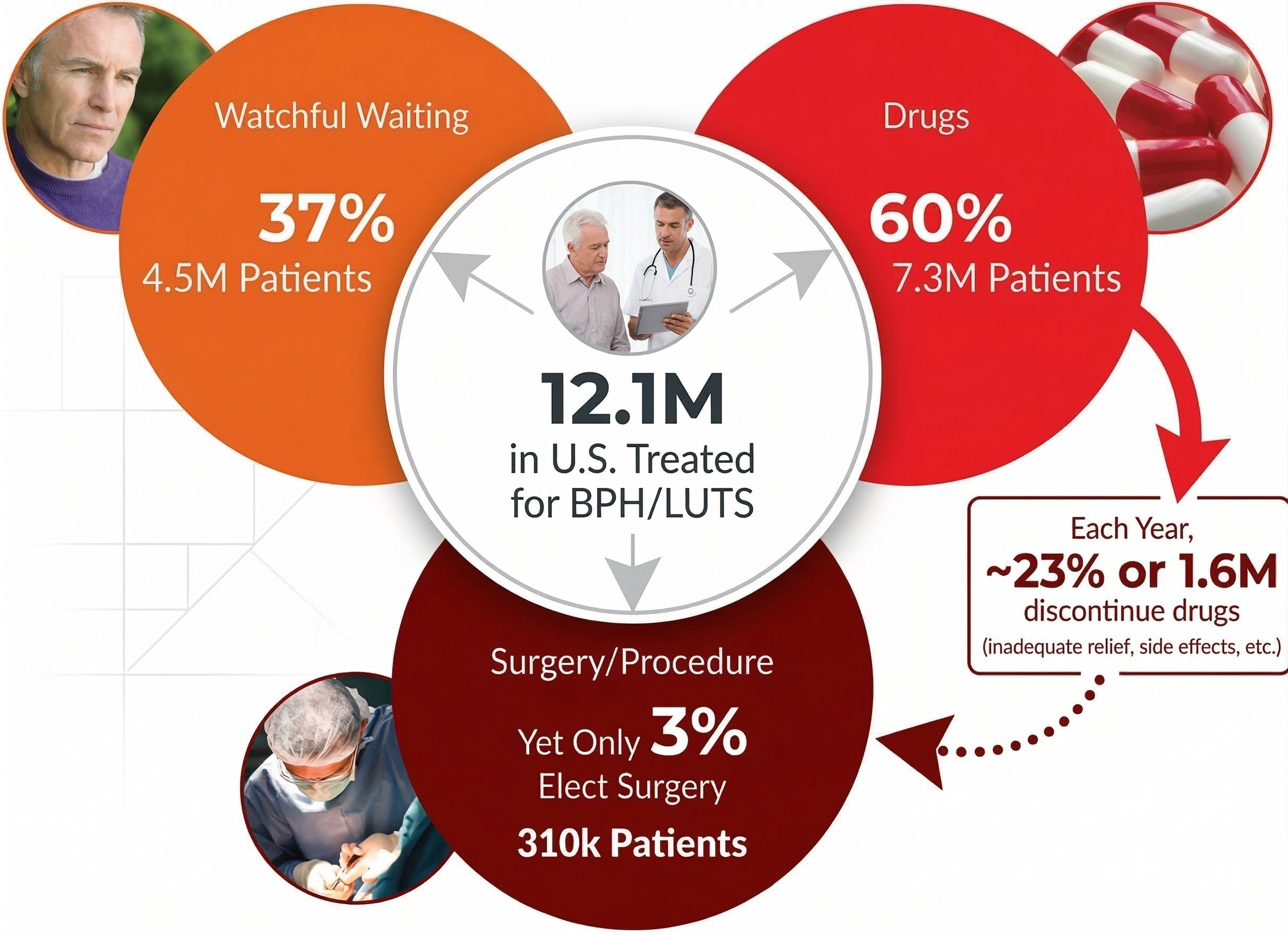 미국 비뇨기과 학회 발표자료 도표