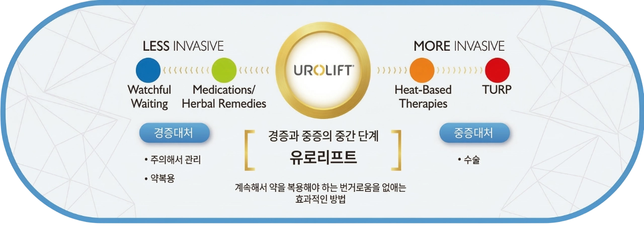 유로리프트 위치 및 치료 단계 설명